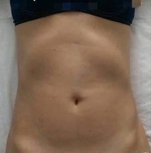 After - Instant Results!